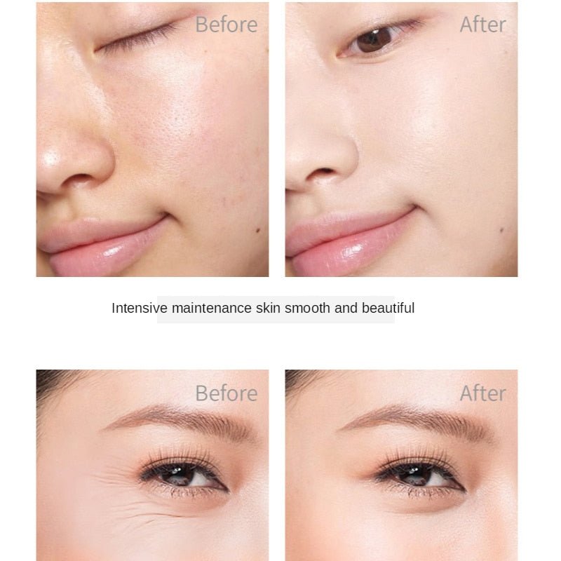 5PCS Luxury Caviar Face Skin Care Set - Moisturizing & Anti - Aging